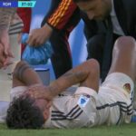 Dybala limps off in tears