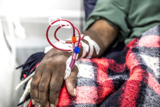 5 Things to Know About Dialysis